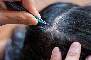 Причины и типы выпадения волос у детей/