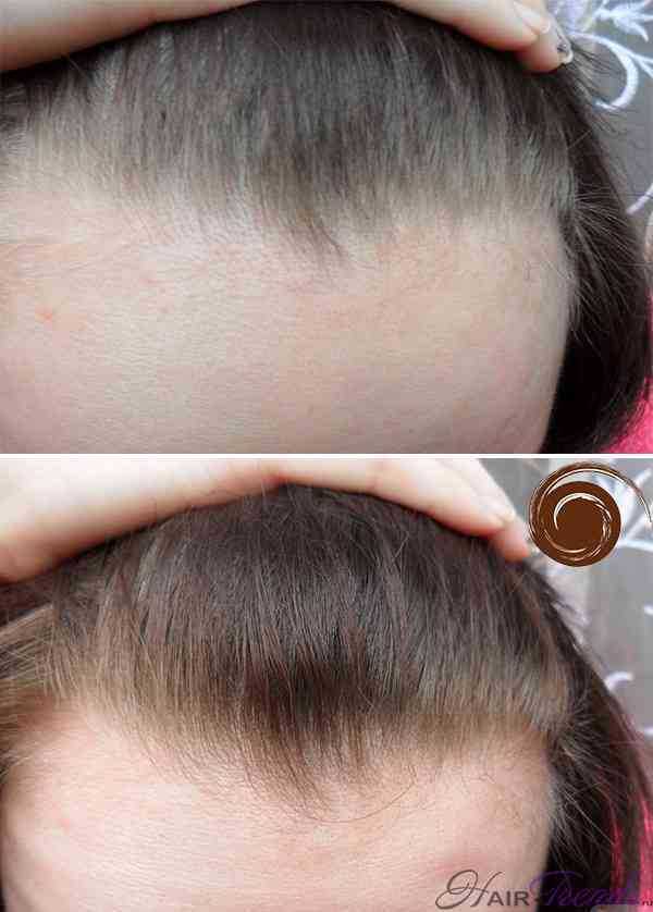 Фото применения коричневого оттенка шампуня Kapous Life Color на неокрашенных ранее волосах: