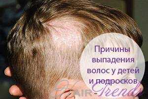Масло калонджи – применение для лечения выпадения волос