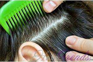 Советы трихологов при выпадения волос