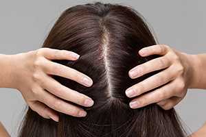 Дефицит какого витамина вызывает выпадение волос и замедление их роста/