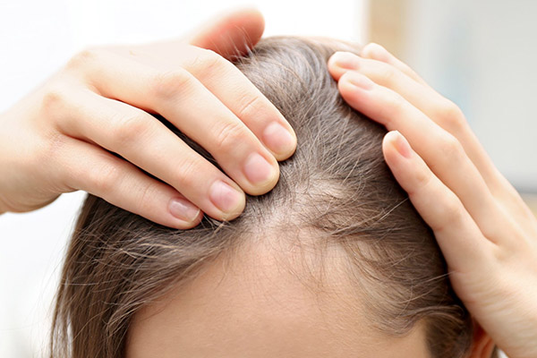 Чрезмерное выпадение волос у 20-летних женщин: причины и лечение