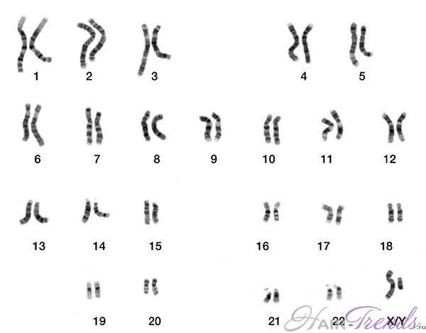 Все 23 пары хромосом у человека мужского пола. Обратите внимание на наличие X и Y! 