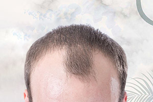 Шампунь Regenepure с кетоконазолом против выпадения волос