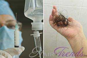 Как пользоваться дермароллером при выпадении волос