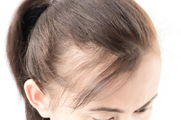 Послеродовое выпадение волос: причины, лечение и профилактика