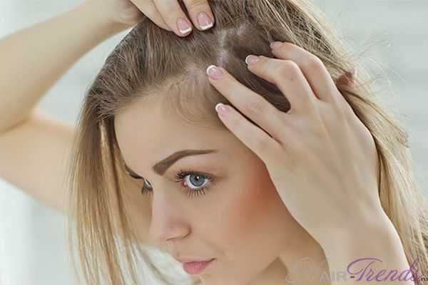 Послеродовое выпадение волос – это не миф