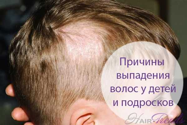 У ребенка сильно выпадают волосы - причины и что делать?