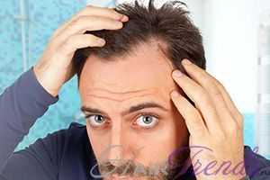 Как выщипывание волос может остановить облысение?