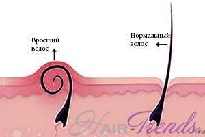 Послеродовое выпадение волос: причины, лечение и профилактика