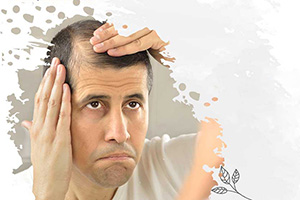 Сильное выпадение волос при мытье головы у мужчин и женщин